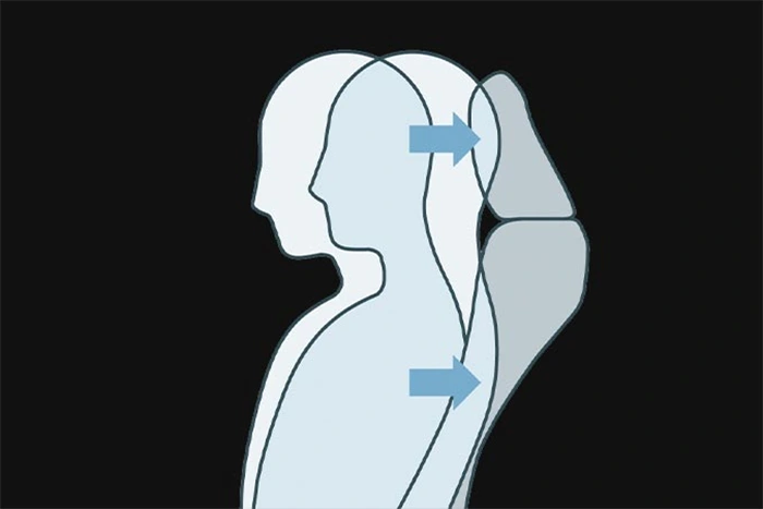 Whiplash Injury Lessening Seat